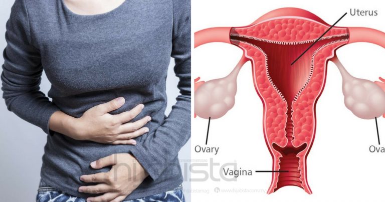 Tak Mahu Kawan Alami Masalah Sama, Wanita Ini Kongsi Kisahnya Kena Buang Ovari Gara-Gara Makan Jamu