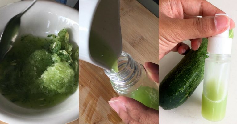 Kalau Kulit Muka Sedang Alami Breakout, Cuba Pakai Toner Timun Ini. Confirm Jerawat Boleh Kecut!