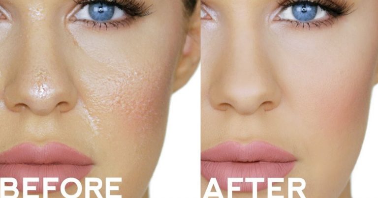 Jangan Benarkan Kulit Kering Menghalang Anda Bersolek, Praktikkan ‘Do & Don’ts’ Untuk Hasil Menawan