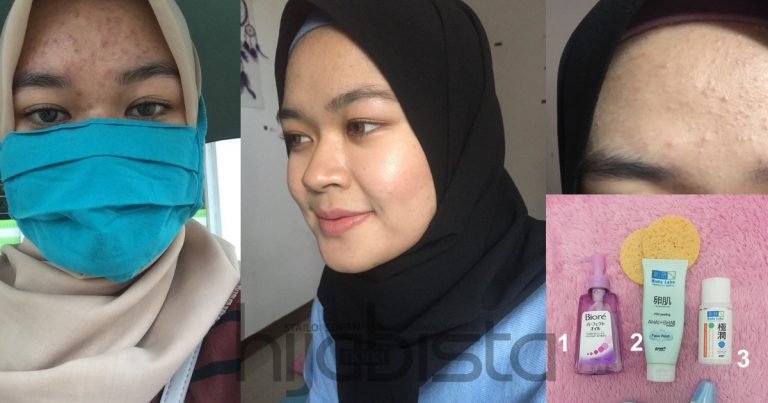 Setelah Puas Cuba, Akhirnya Doktor Gigi Ini Rawat Kulit ‘Breakout’ Dengan Hanya Produk Bajet Dari Drugstore