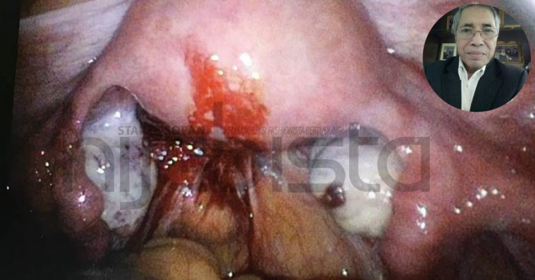 Senggugut Waktu Remaja Berisiko Dapat Endometriosis. Ini Pesanan Dr Hamid Arshat Yang Hijabi Perlu Alert!