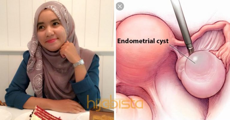 Ovari Hampir Dibuang, Gadis Ini Kongsi Pengalaman Derita Akibat Cyst Buat Pengajaran Semua