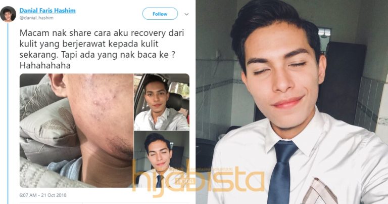 Dapat Ribuan Retweet, Lelaki Ini Kongsi Cara Pulih Dari Breakout Dengan Kos Murah