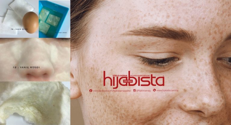 Whitehead & Blackhead Boleh Hilang Dengan Dua Bahan Ini, Serendah 40 Sen. Murah Dan Berkesan!