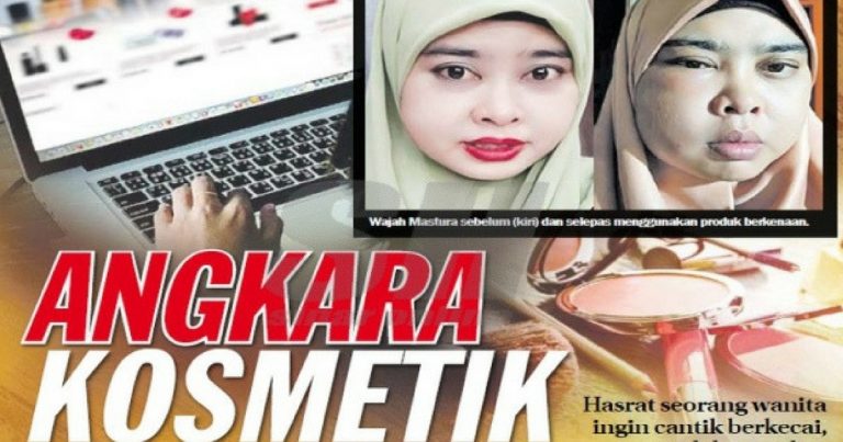 10 Hari Wanita Ini Tahan Sakit Kulit Pedih, Merah, BENGKAK & Sukar TIDUR Gara-Gara Beli KOSMETIK Di Internet