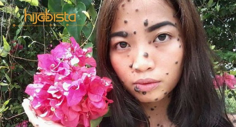 Hukum Menghilangkan Tahi Lalat Menurut Islam. Amalkan Cara Alami Dijamin Selamat