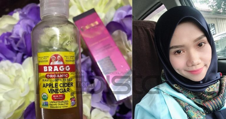 Wanita Ini Kongsi 5 Manfaat Cuka Epal Untuk Kesan Awet Muda. No 4 Tu Macam Tak Percaya Jer!
