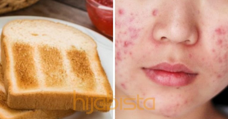 Hati-Hati! Sebenarnya Makan Roti Adalah Punca Terjadinya Jerawat Anda