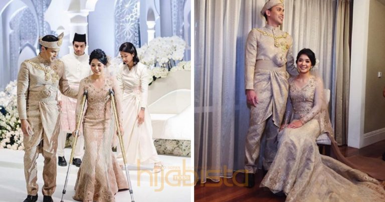 Walaupun Terpaksa Bertongkat Akibat Cedera Lepas Selamatkan Kucing,Pengantin Ini Tetap Menawan!