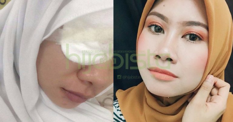 Hampir Buta Gara-Gara Contact Lens, Gadis Ini Kongsi Cara Penjagaan Contact Lens Yang Tepat Mengikut Saranan Doktor Pakar Mata