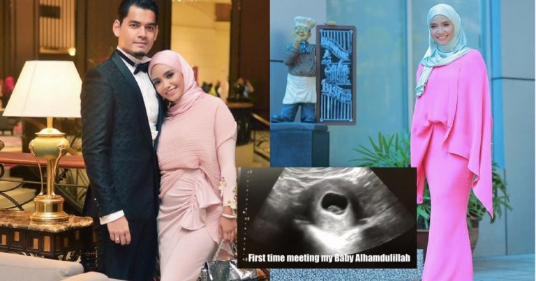Ummi Nazeera Teruja Hamil 4 Bulan,  Kongsi ‘Ultrasound Baby’ Kali Pertama Di Laman Sosial