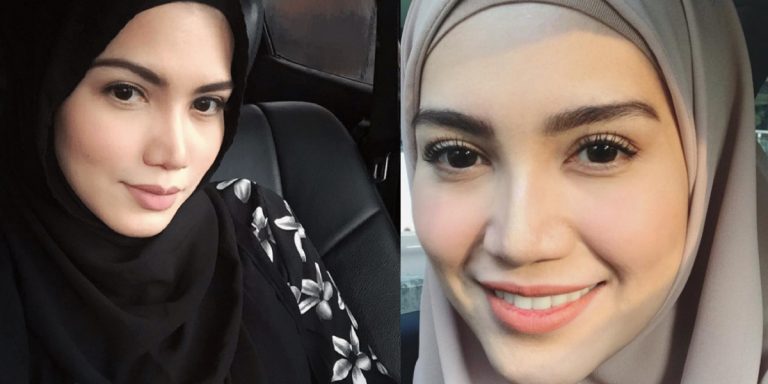 Separuh Hidup Menahan Sakit, Elyana Sembunyikan Diri Elak Deritanya Diketahui Umum